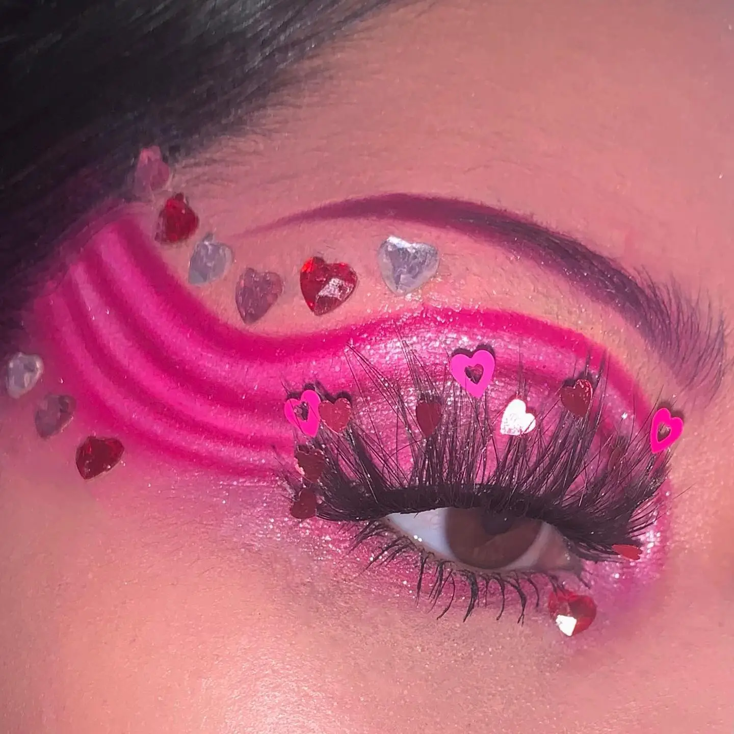 Pink eye